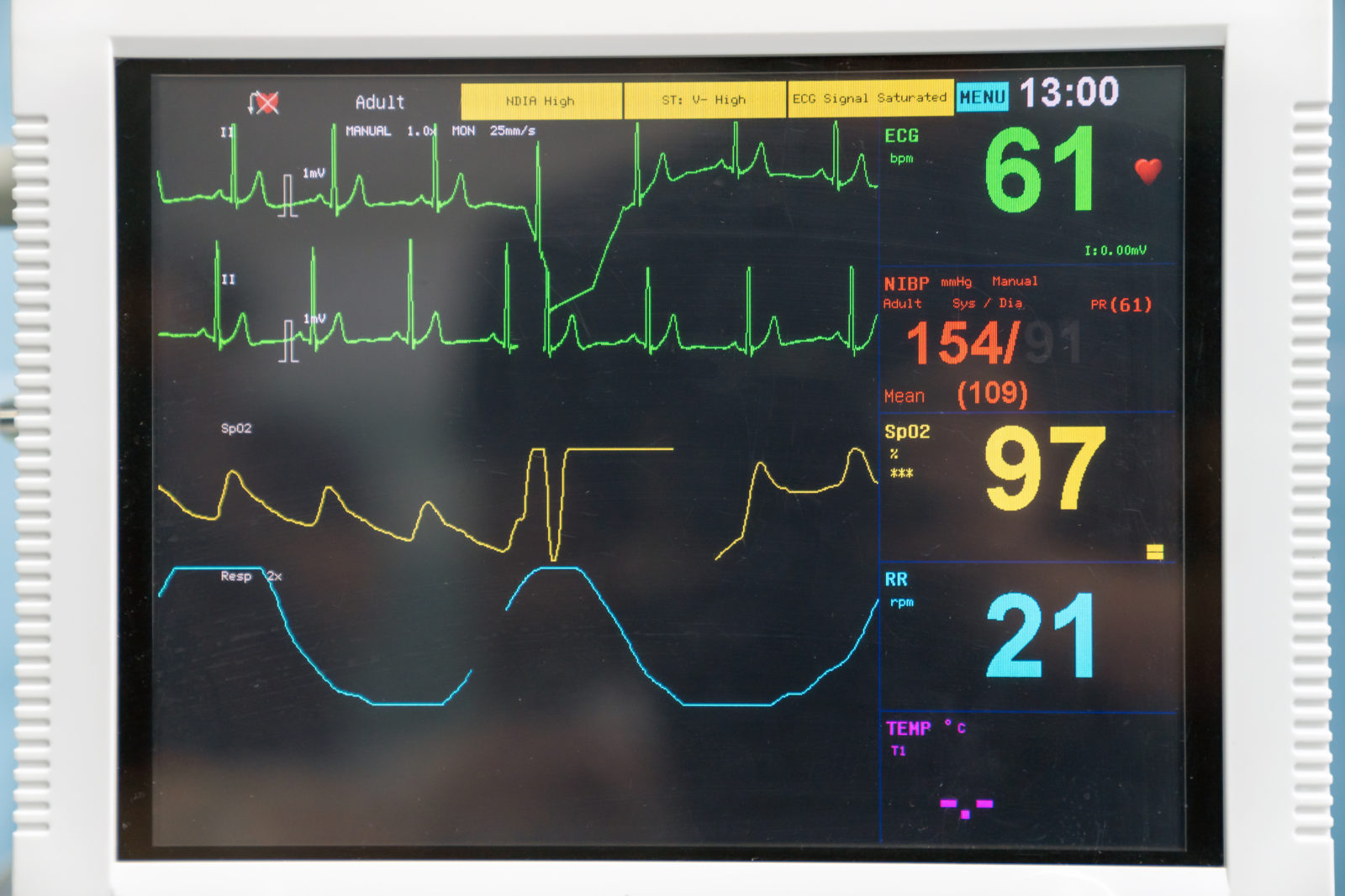 Ekg Machine In Hospital Emergency Room Used For Heart Attack Dia EKG as monitoring